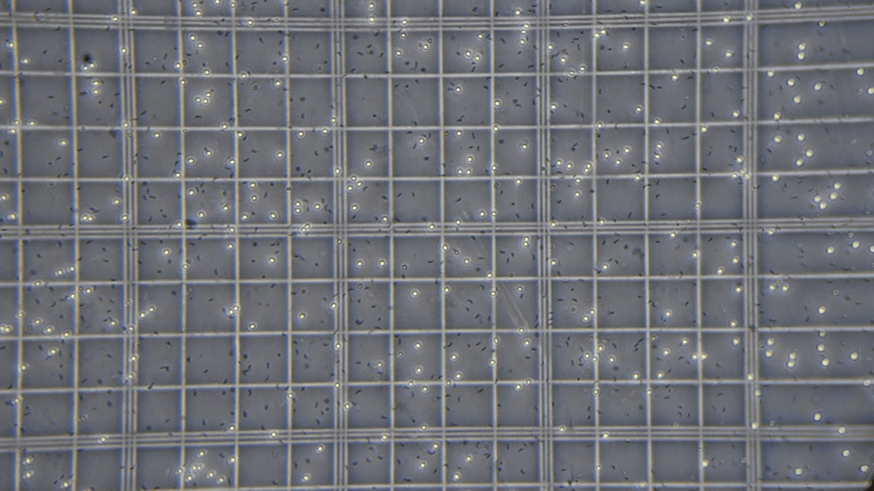 Image credit and caption: Dr. Matthew Knox. Cryptosporidium oocysts (circular objects) and sporozoites (black banana shapes). Intact (unexcysted) oocysts appear as white circles, excysted oocyst shells as faded grey circles. Each intact oocyst contains four sporozoites.