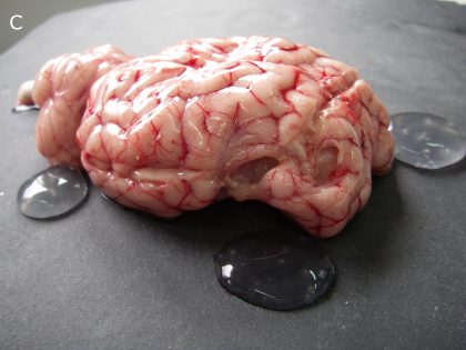 Coenurus cerebralis in a brain of infected sheep (courtesy of Prof. Antonio Varcasia, Department of Veterinary Medicine, University of Sassari, Sassari, Italy)