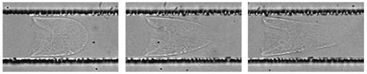 Figure 3. A strain-softening elastic capsule flows through a microchannel (the capsule is on the order of micrometers). The capsule is seen to stretch and pull, eventually rupturing in the third frame.