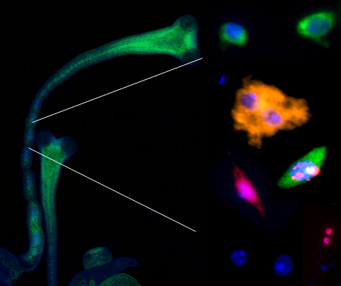 Credit: Images from our laboratory. On the left, a segmented worm showing the presence of a specific messenger RNA in its reproductive organs. On the right, some of the cell-types present at the parasite that we were able to characterize.